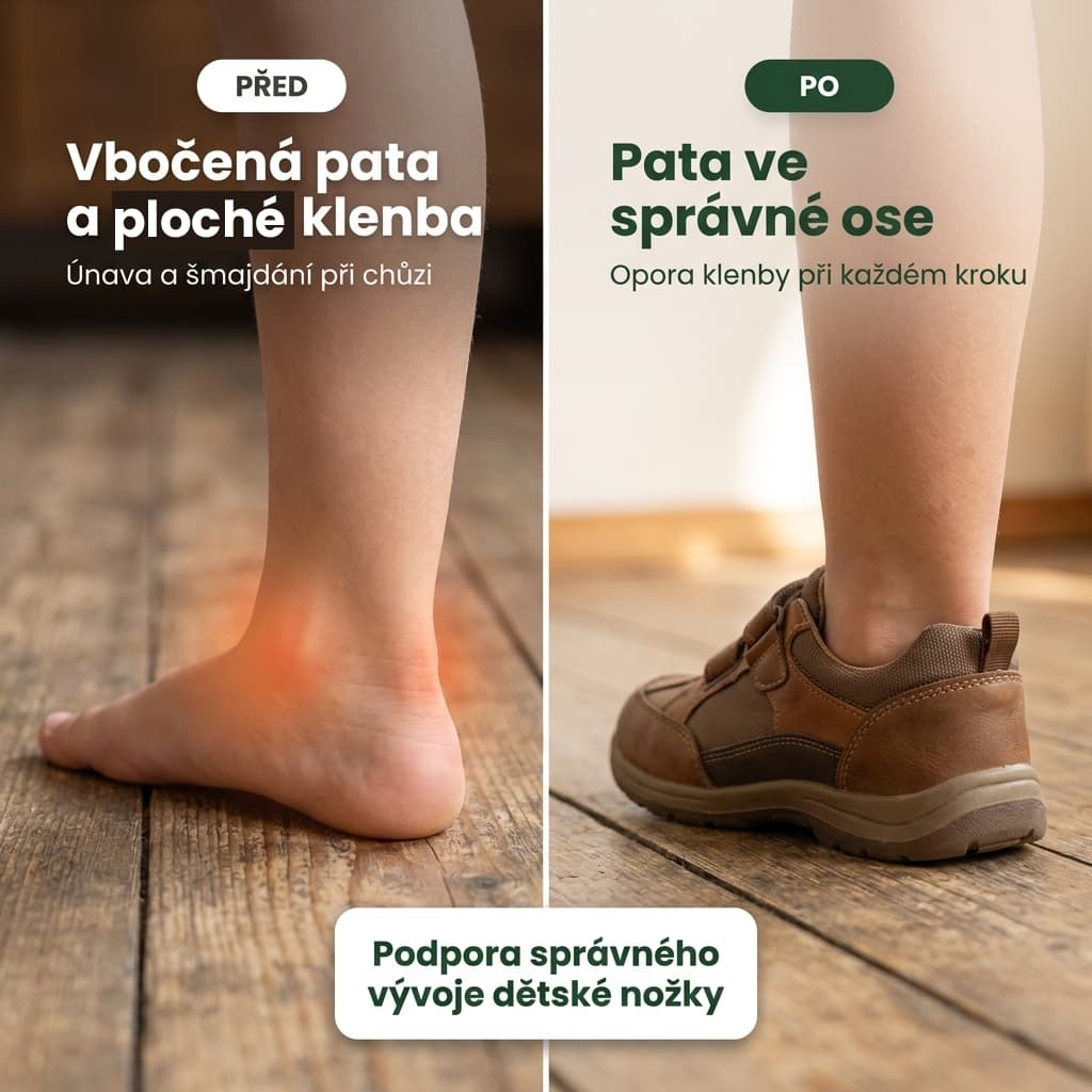 Dětské ortopedické vložky před a po – pata ve správné ose a opora klenby